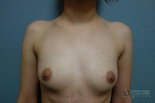 photo_gallery_before1511case_1.jpg