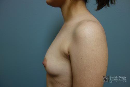 photo_gallery_before1511case_3.jpg