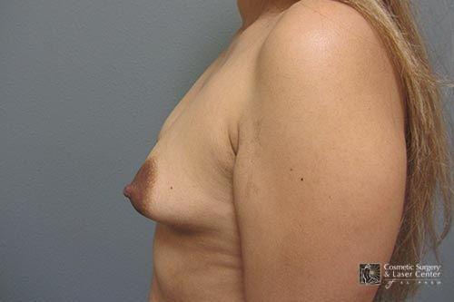 photo_gallery_before1512case_2.jpg
