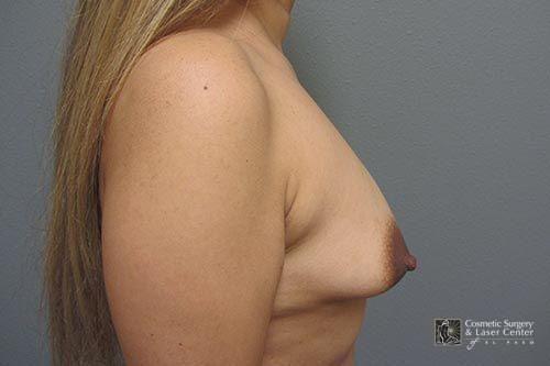 photo_gallery_before1512case_3.jpg