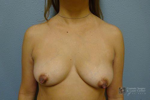 photo_gallery_before1517case_1.jpg