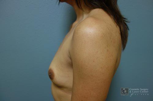 photo_gallery_before1524case_3.jpg