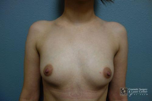 photo_gallery_before1543case_1.jpg