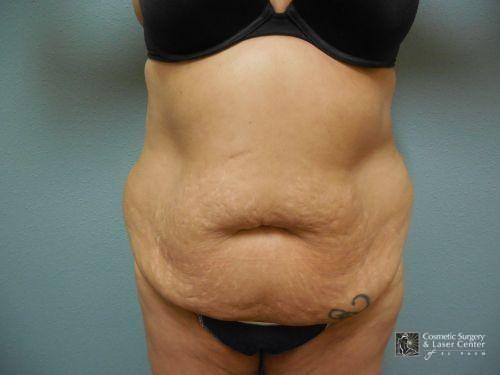 photo_gallery_before1560case_1.jpg