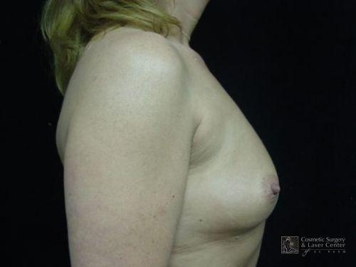 photo_gallery_before169case_2.jpg