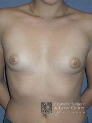 photo_gallery_before246case_1.jpg