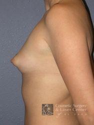 photo_gallery_before246case_3.jpg