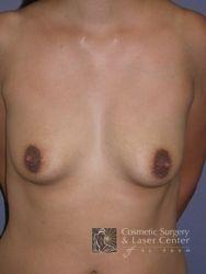 photo_gallery_before249case_1.jpg