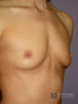 photo_gallery_before253case_2.jpg