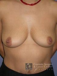photo_gallery_before256case_1.jpg