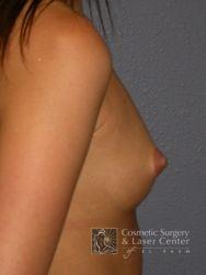 photo_gallery_before260case_3.jpg