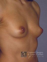 photo_gallery_before261case_2.jpg