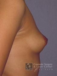 photo_gallery_before261case_3.jpg