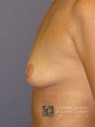 photo_gallery_before262case_3.jpg