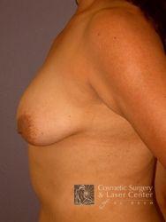 photo_gallery_before280case_2.jpg