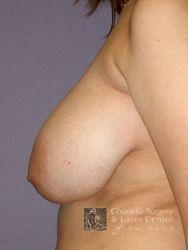 photo_gallery_before295case_3.jpg