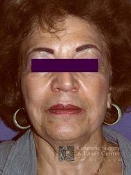 photo_gallery_before306case_1.jpg