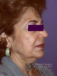 photo_gallery_before306case_2.jpg