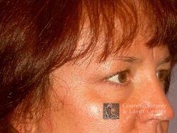 photo_gallery_before316case_2.jpg