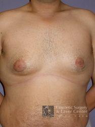 photo_gallery_before337case_1.jpg