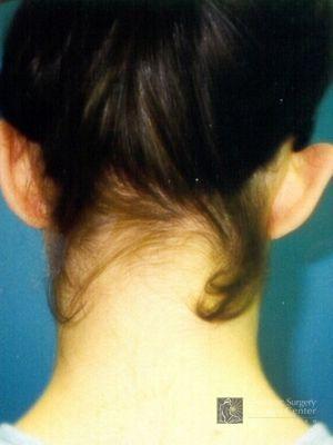 photo_gallery_before359case_2.jpg