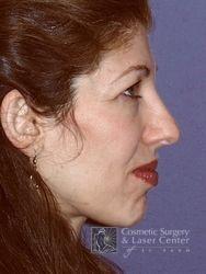 photo_gallery_before364case_1.jpg