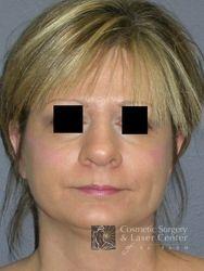 photo_gallery_before371case_1.jpg