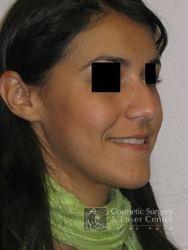 photo_gallery_before375case_2.jpg