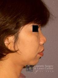 photo_gallery_before382case_3.jpg