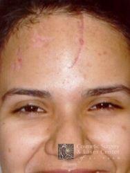 photo_gallery_before386case_1.jpg