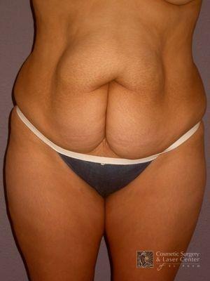 photo_gallery_before396case_1.jpg