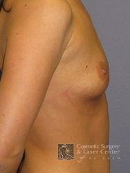 photo_gallery_before421case_2.jpg