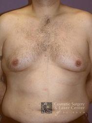 photo_gallery_before443case_1.jpg
