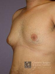 photo_gallery_before446case_3.jpg
