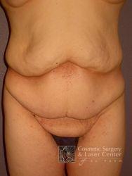 photo_gallery_before448case_1.jpg
