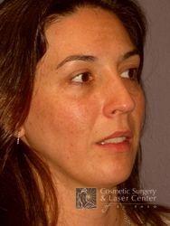 photo_gallery_before453case_2.jpg