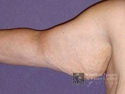 photo_gallery_before461case_1.jpg