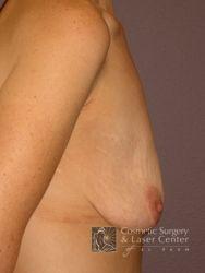 photo_gallery_before462case_3.jpg