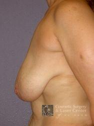 photo_gallery_before463case_3.jpg