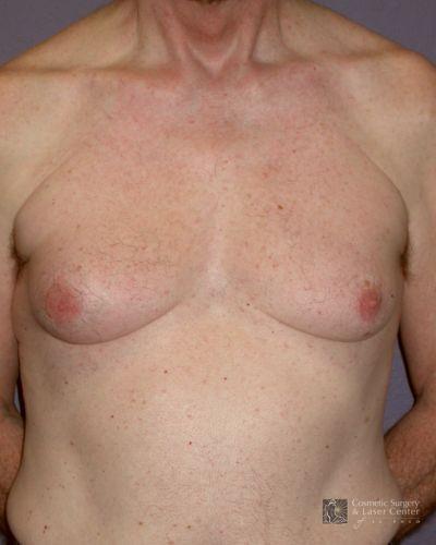 photo_gallery_before486case_1.jpg
