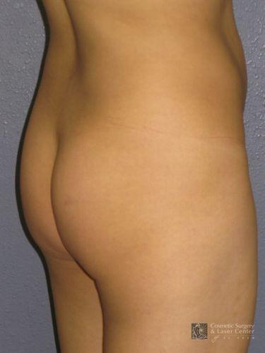 photo_gallery_before489case_4.jpg