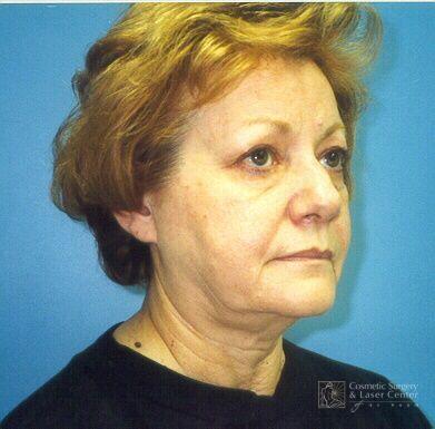 photo_gallery_before495case_1.jpg