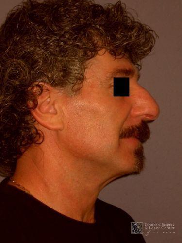 photo_gallery_before496case_1.jpg