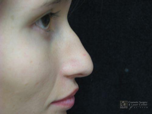 photo_gallery_before518case_1.jpg