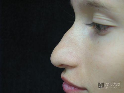 photo_gallery_before518case_2.jpg