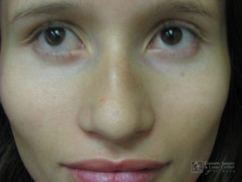 photo_gallery_before518case_3.jpg