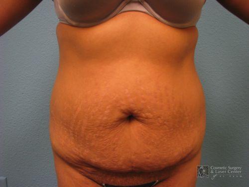 photo_gallery_before524case_1.jpg