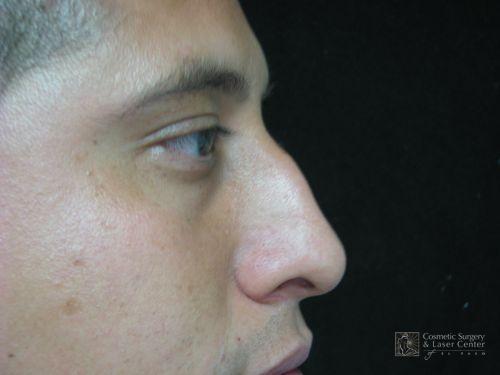 photo_gallery_before534case_1.jpg