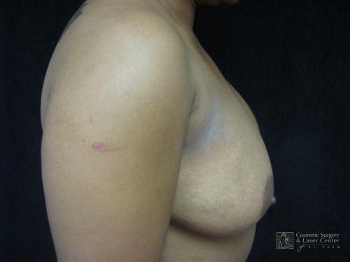photo_gallery_before552case_2.jpg