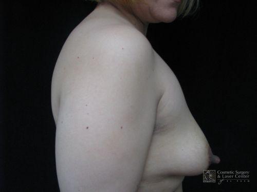 photo_gallery_before554case_2.jpg
